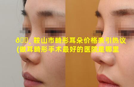 🌸 鞍山市畸形耳朵价格表引热议(做耳畸形手术最好的医院是哪里)